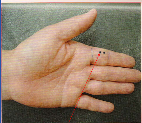 董氏奇穴-大间穴