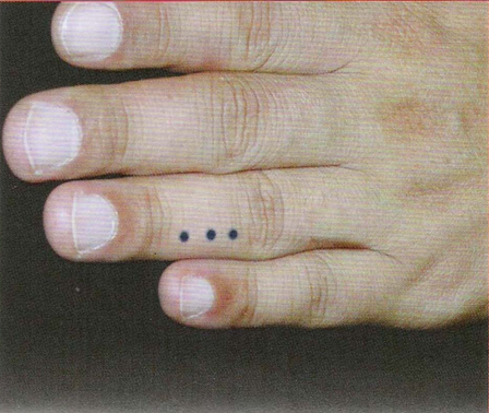 董氏奇穴-指三重穴